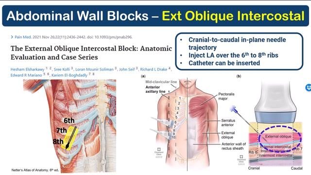 External Oblique Intercostal Block - Anatomical Principles [Nov 2023]