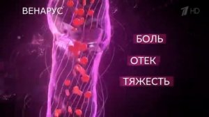 Реклама Венарус Варикоз под контролем   Июль и Август 2019