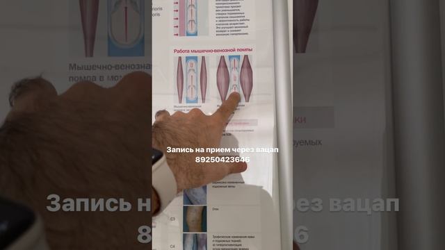 Здоровая вена. Как лечить варикоз. Лечение варикоза. УЗИ сосудов. Флеболог Москва. Флеболог смотреть онлайн