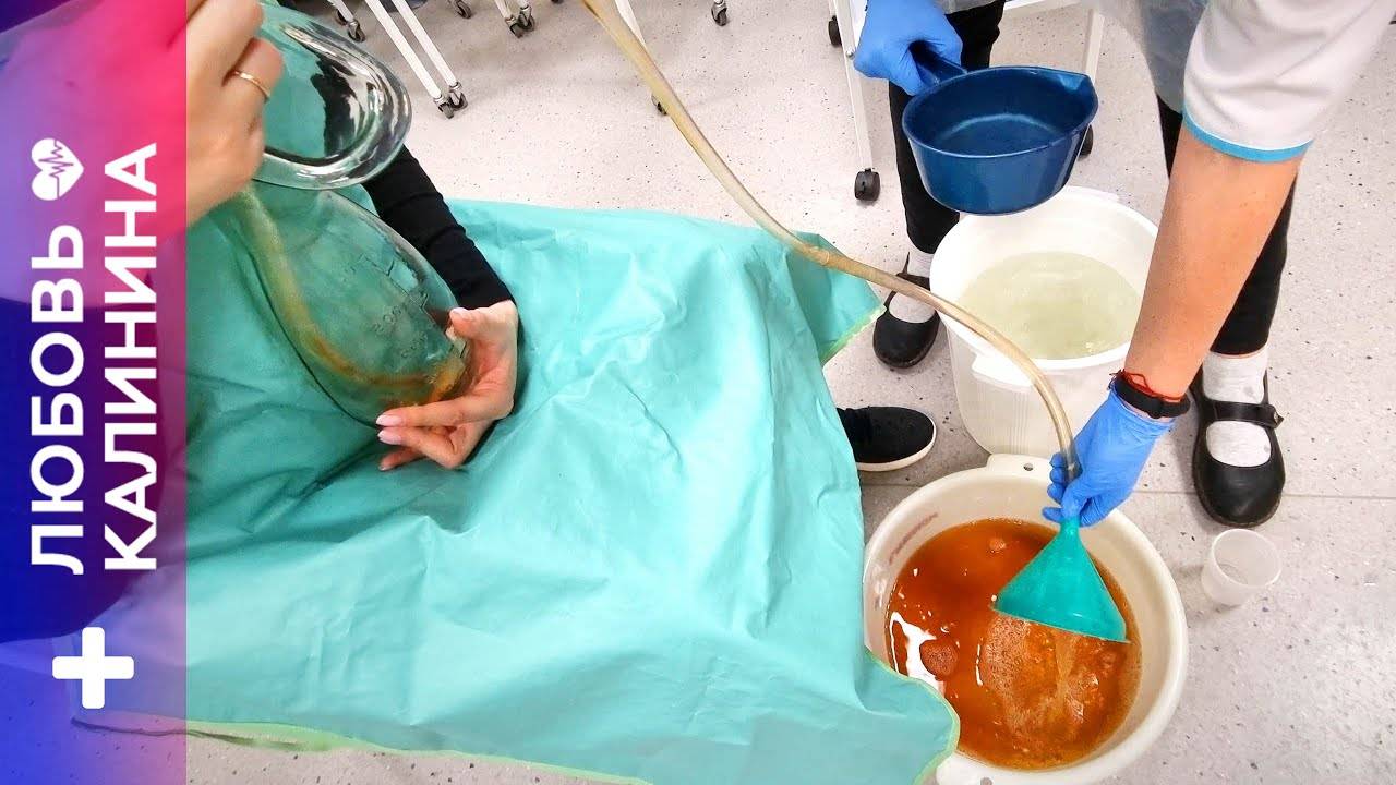 10. Промывание желудка толстым зондом | Л.Калинина смотреть онлайн
