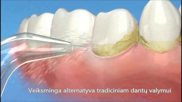 Burnos irigarorius H2O Floss - Burnos higiena смотреть онлайн