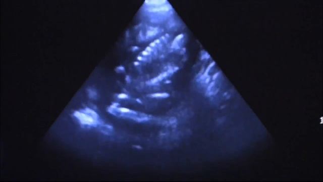 Wild Encounters: Pregnant Lions смотреть онлайн