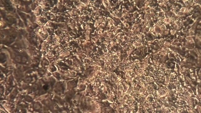 Beating Heart Cells Infected With Synthetic SARS-CoV-2 Virus смотреть онлайн