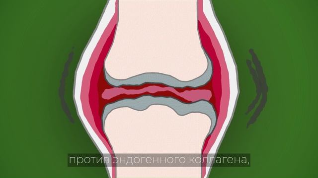 Хондрогард Трио Что бы суставы не болели