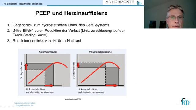 Beatmung - advanced - Hartmut Brestrich - Intensivmedizin Repetitorium Online Kurs смотреть онлайн