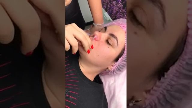 Воск остался в носу. Что делать? смотреть онлайн