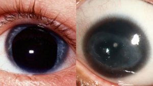 Самые Редкие Цвета Глаз у Людей