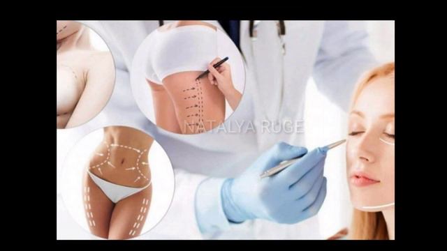 80.#ОТВЕТЫ НА #ВОПРОСЫ. #РОДИНКИ.#ПЛАСТИЧЕСКАЯ#ХИРУРГИЯ. #ЭПИЛЕПСИЯ. Ответы контактёра.23.02.2021. смотреть онлайн