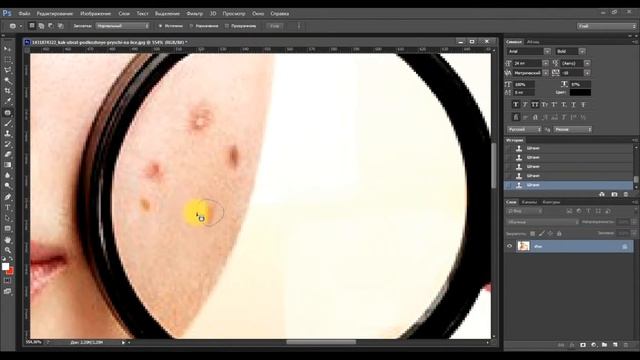 Как убрать прыщи в фотошопе. Как удалить прыщи, изъяны c помощью штампа и заплатки.? смотреть онлайн