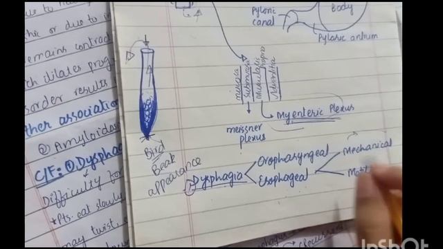 Achalasia Cardia:Pathophysiology and clinical features(Part 01)|Motility disorders|Esophagus|GIT смотреть онлайн
