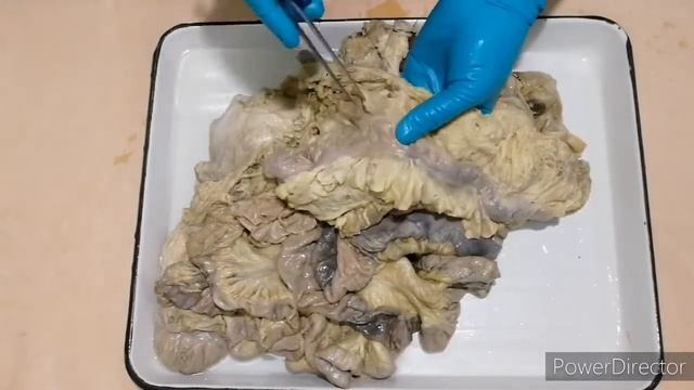 Брыжеечная часть тонкой кишки Толстая кишка смотреть онлайн