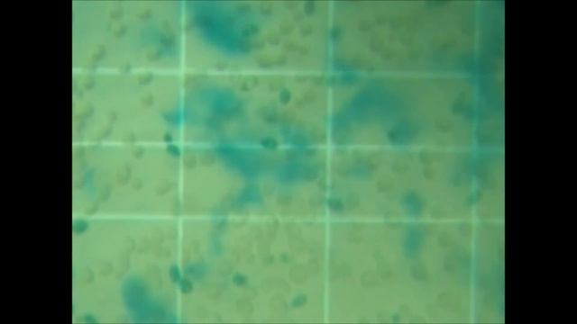 Cytotoxicity Saccharomyces boulardii L смотреть онлайн