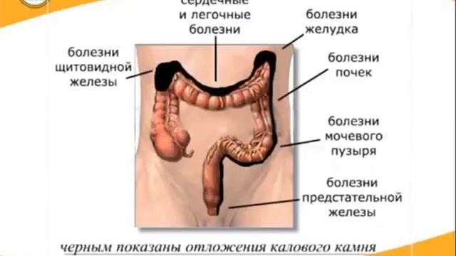 Правильный приём СОЛИ NAYUTA 880 смотреть онлайн