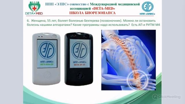Болезнь Бехтерова у женщины 55 лет 2021.03.17 смотреть онлайн