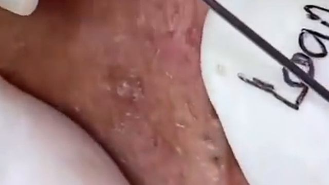 Черные точки