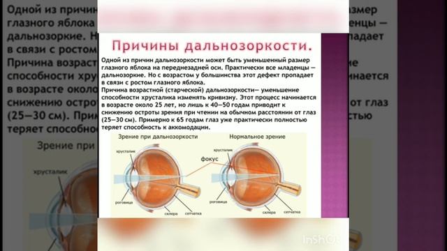 8 класс. Глаз как оптическая система, дефекты зрения и способы их исправления смотреть онлайн