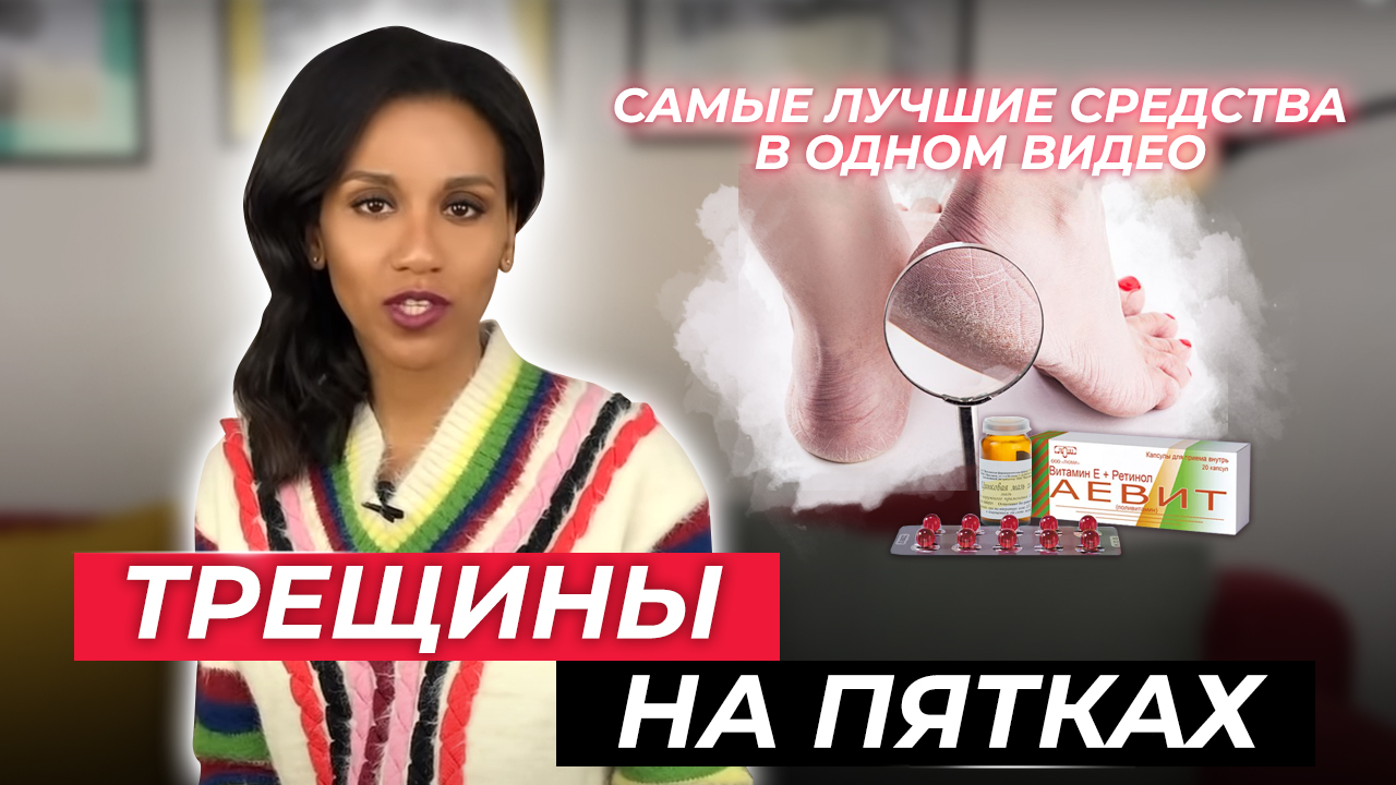 Избавьтесь от трещин на пятках раз и навсегда // Трещины на пятках до и после 50лет: Лучшие средства смотреть онлайн
