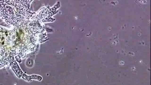 Амеба протей. Amoeba proteus смотреть онлайн