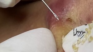 Enjoy Every Day With The Best Video Loan Nguyen Spa Official  2634