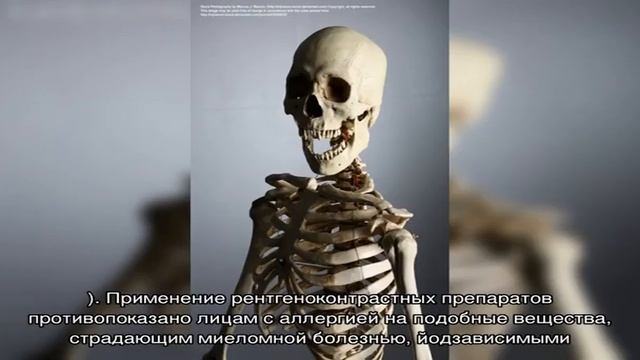 КТ лицевого отдела черепа в Москве смотреть онлайн