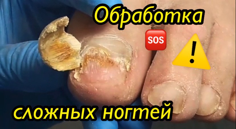 Обработка сложных ногтей ??⚠️❗️?? смотреть онлайн