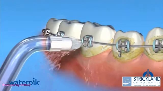 Waterpik SO смотреть онлайн