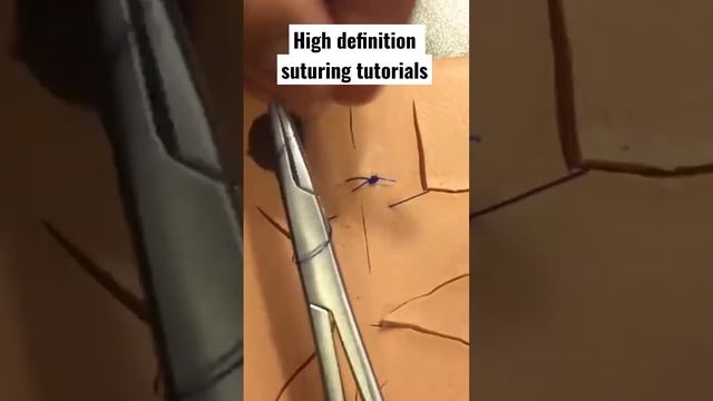 Simple interrupted suturing in HD ? ? смотреть онлайн