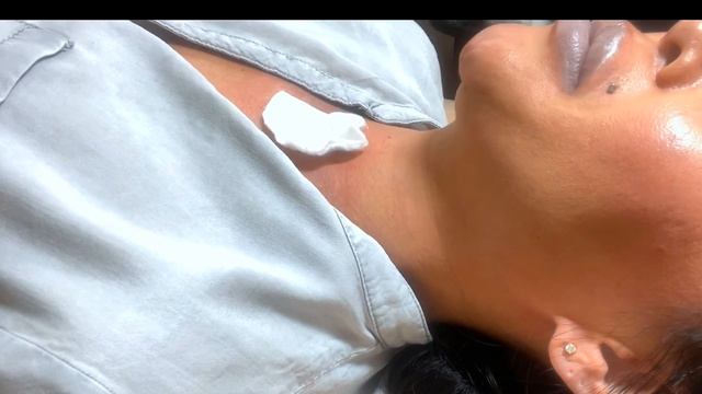 Установка подкожного микродермала смотреть онлайн