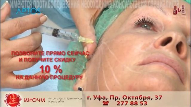 ИНОЧИ нити аптос смотреть онлайн