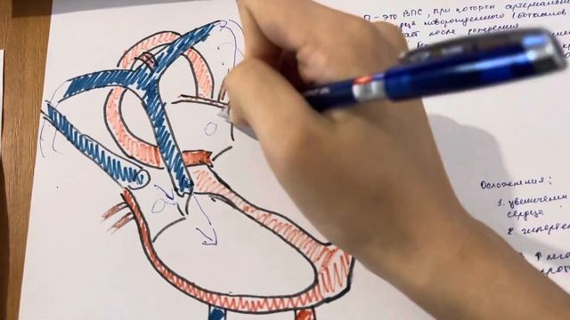 Открытый артериальный проток