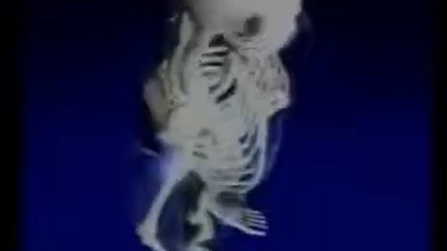 Остеопороз и Подагра - Лечение Щелочной ионизированной водой Kangen смотреть онлайн