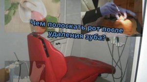 Чем полоскать рот после удаления зуба?