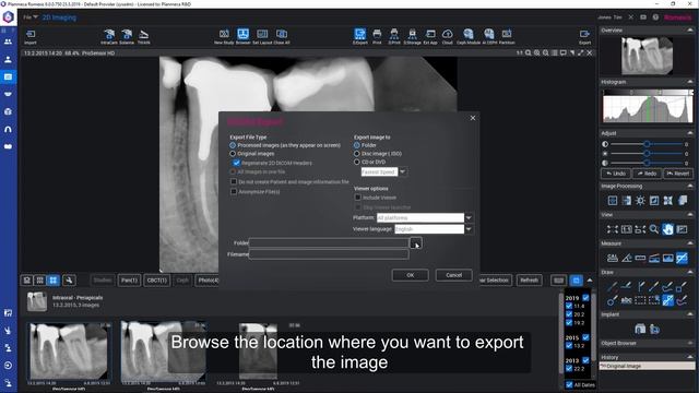 Romexis How To: Export 2d image in dicom format смотреть онлайн