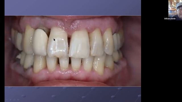 Ozone in Hygiene Practice смотреть онлайн