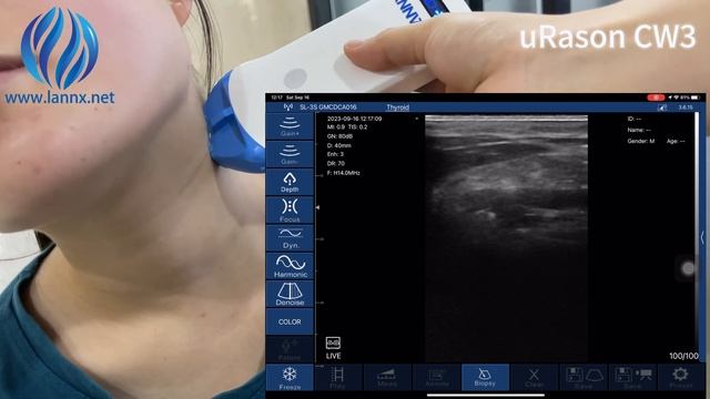 How to Handle Needle Ultrasound Probe Wireless USG Probe uRason CW3? смотреть онлайн