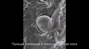 Клетки человека под электронным микроскопом