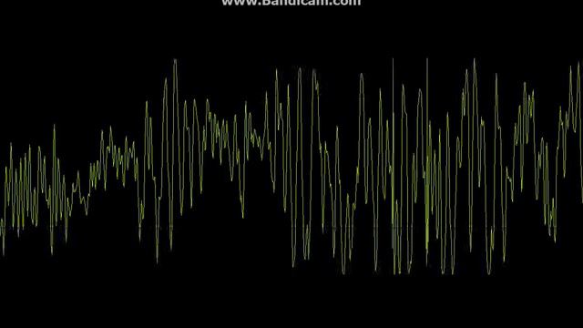 Графо-музыка №6-Ант25 17 Виражи смотреть онлайн