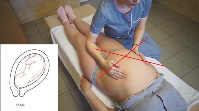 Наружное акушерское исследование (по Леопольду-Левицкому)