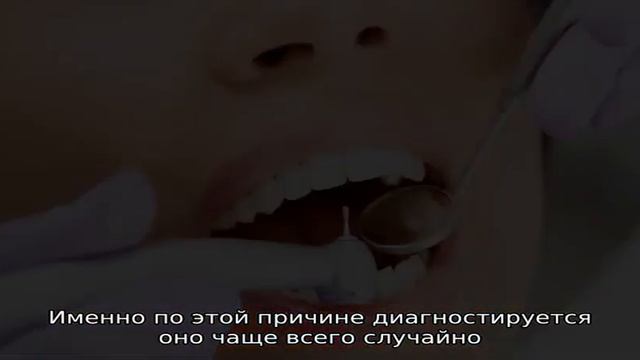 Киста смотреть онлайн