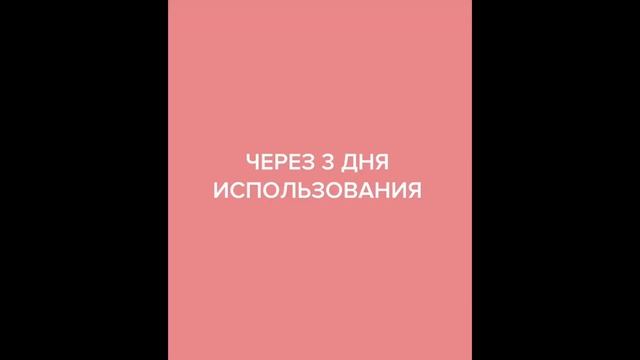 СЫВОРОТКА КОНТРОЛЬ СЕБУМА И ПОР ОТ RICHE смотреть онлайн