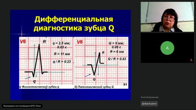 17-04-24 Варианты нормальной ЭКГ. Куприянова АВ смотреть онлайн