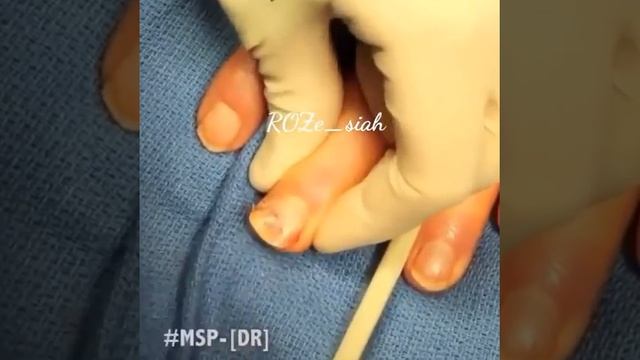 Вырывание ногтя ЖЕСТЬ смотреть онлайн