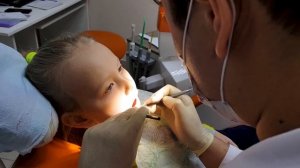 Удаление зубов у детей