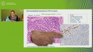 Нейроэндокринные опухоли желудка: классификация и клинико-морфологические типы