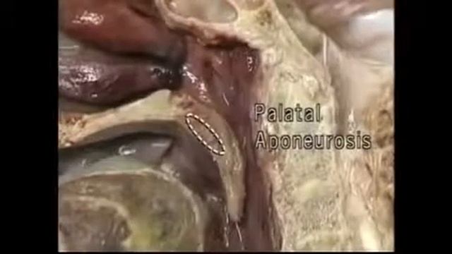 Анатомия смотреть онлайн