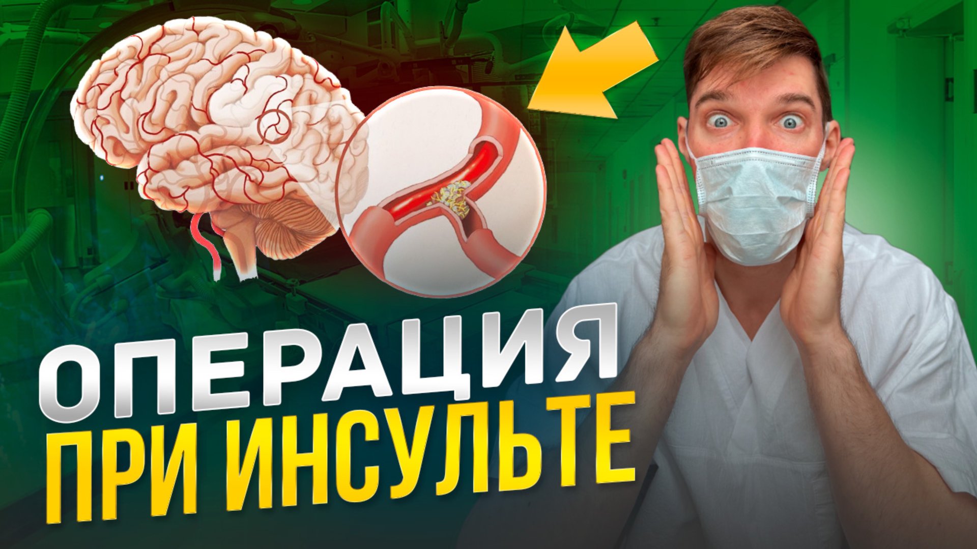 Операция тромбоэкстракция при инсульте. Показания при ОНМК. смотреть онлайн