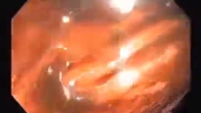 Хотите увидеть почему здоровье человека зависит от кишечника смотреть онлайн