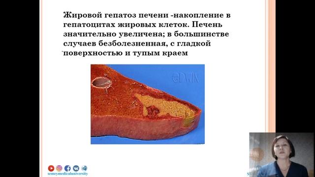 Гепатомегалия смотреть онлайн