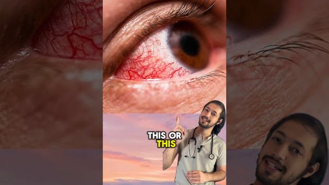 Physical signs and Manifestation of high Blood Glucose/Sugar #glucose #sugar #diabetes смотреть онлайн