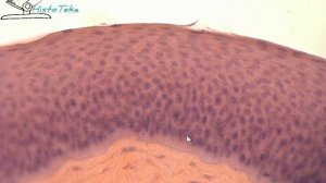 МНОГОСЛОЙНЫЙ ПЛОСКИЙ НЕОРОГОВЕВАЮЩИЙ ЭПИТЕЛИЙ